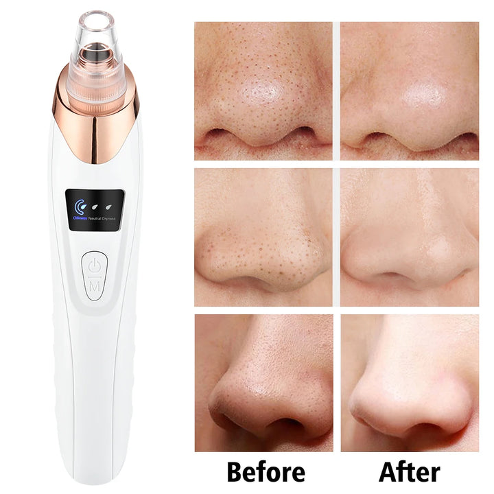 Multifunctional Beauty Pore Vacuum