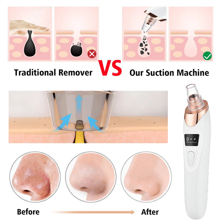 Multifunctional Beauty Pore Vacuum